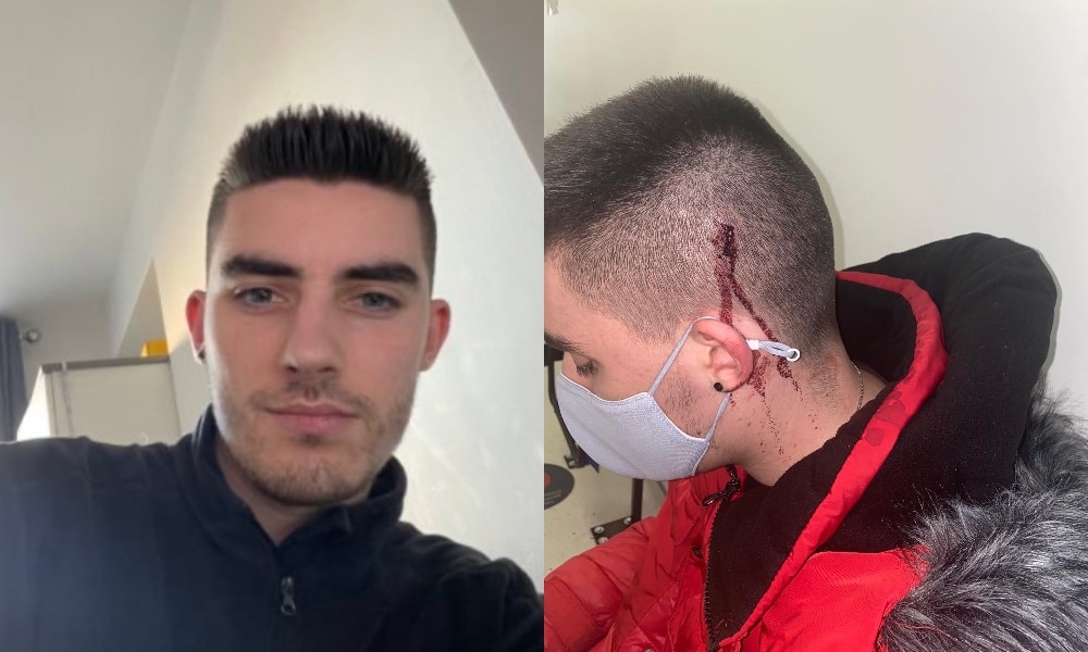 Student battered and bloodied in 'homophobic attack' outside London gay club Heaven