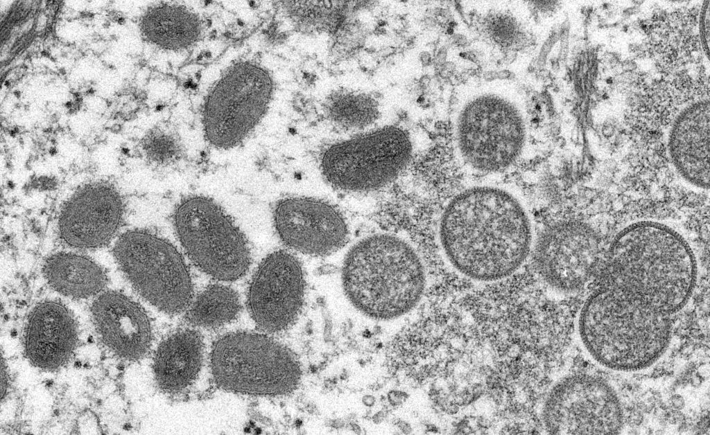 Microscope image of the monkeypox virus