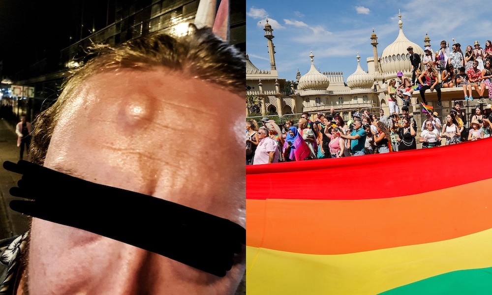 Non-binary person injured by 'toilet-policing' pub worker during Brighton Pride