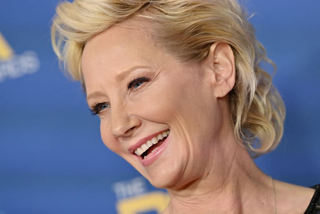 Anne Heche 'stable' after horror car crash and 4 more essential things you need to know
