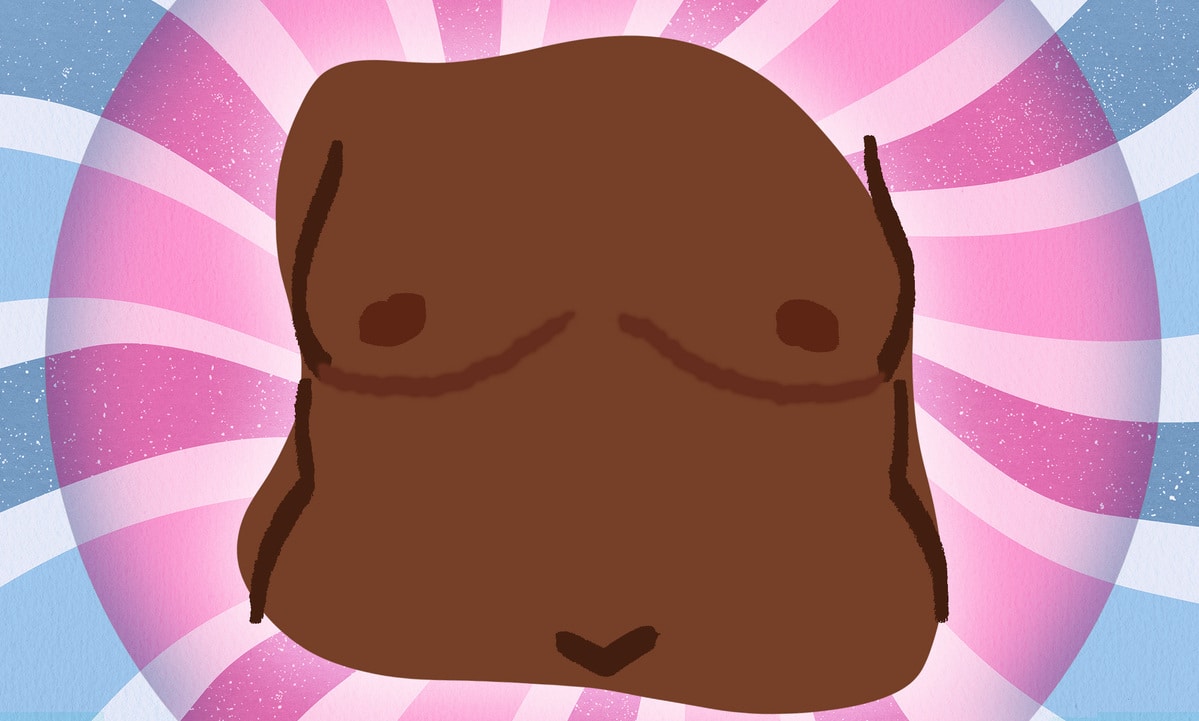 Top surgery dramatically improves quality of life for young trans adults, study finds