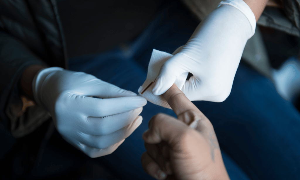 A person is tested for HIV by a medical professional 