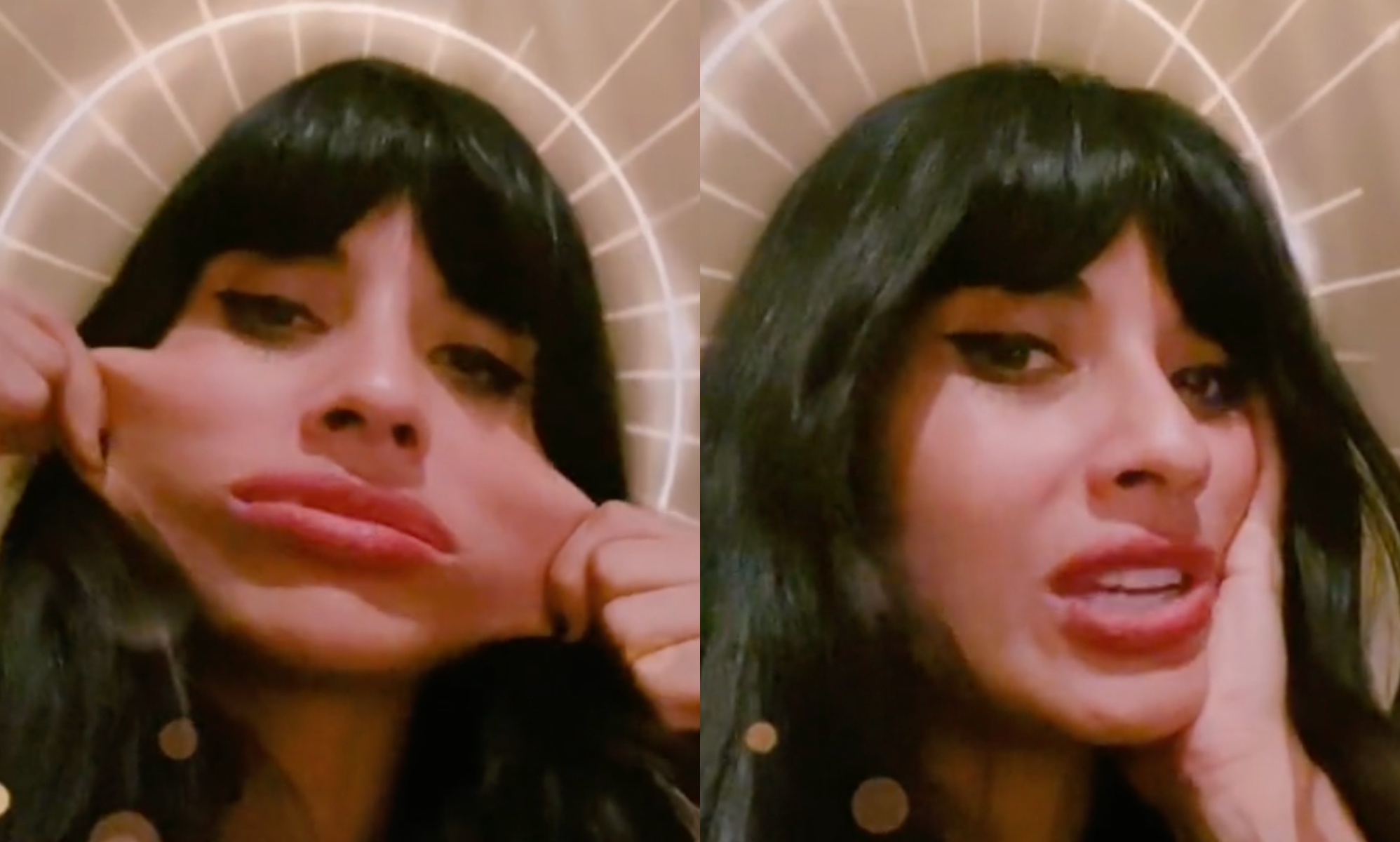Jameela Jamil shows 'elastic skin' as she opens up about rare Ehlers-Danlos syndrome