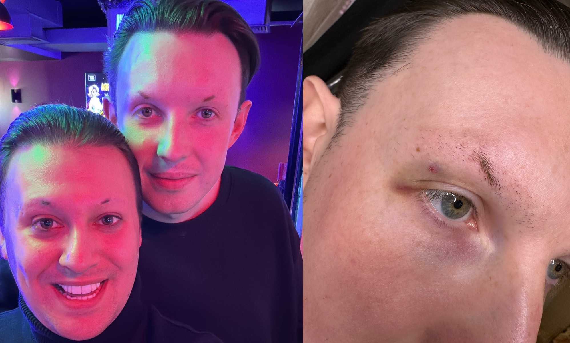 Drag queen husbands 'traumatised' after being brutally attacked in street just for holding hands