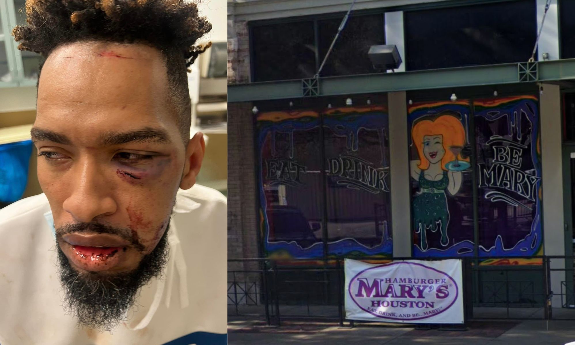 Gay man beaten by bouncers and left with broken leg in harrowing attack caught on camera