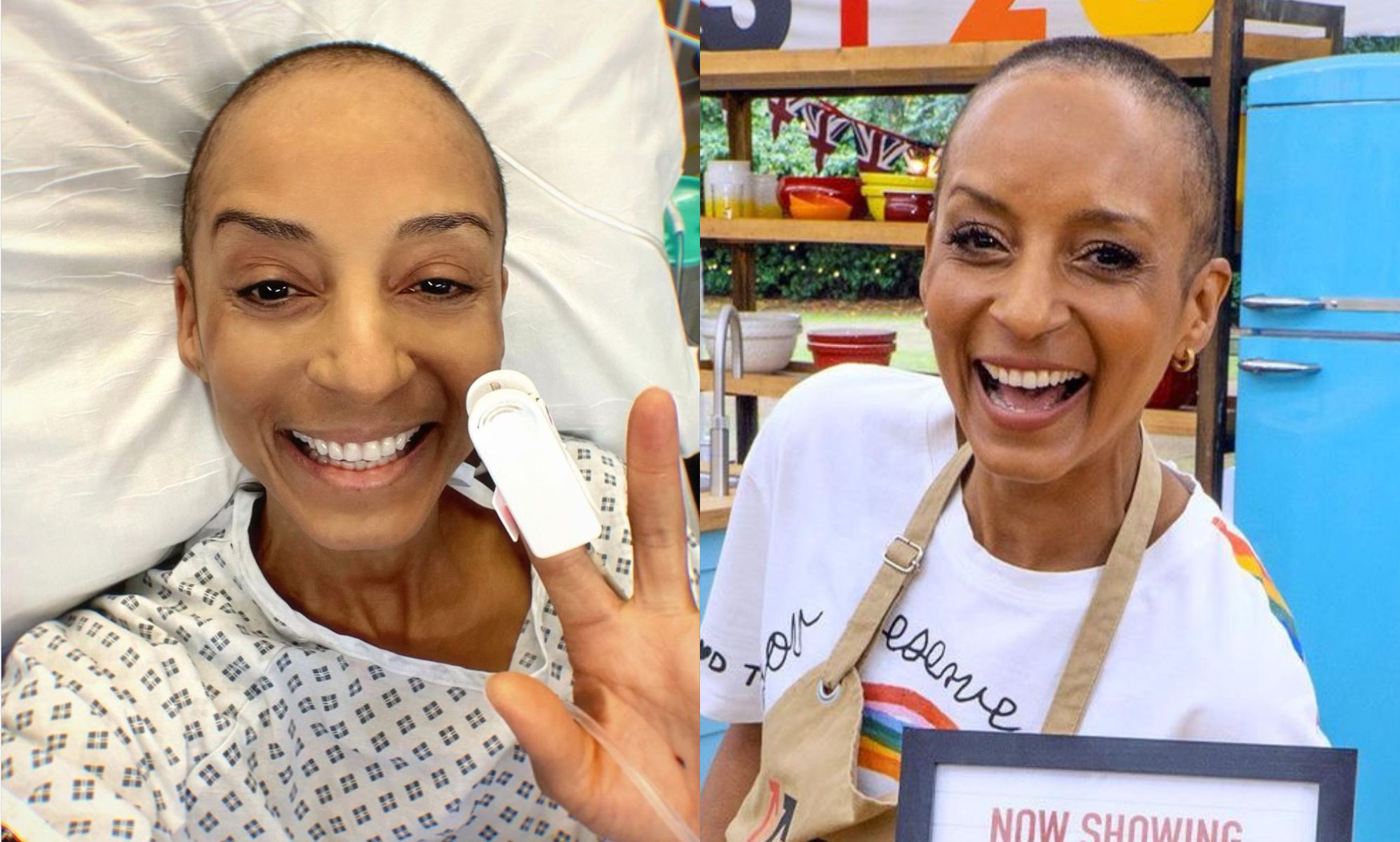 Adele Roberts reveals chemotherapy treatment during Celebrity Bake Off: 'I can't remember most of it'