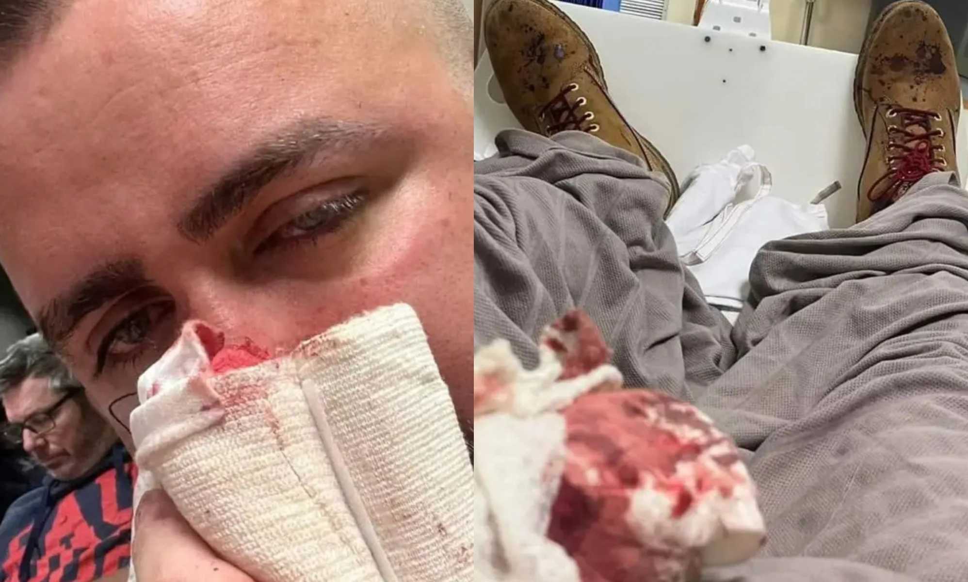 Two gay men left bloodied in horrific 'homophobic' attack while on night out in Perth