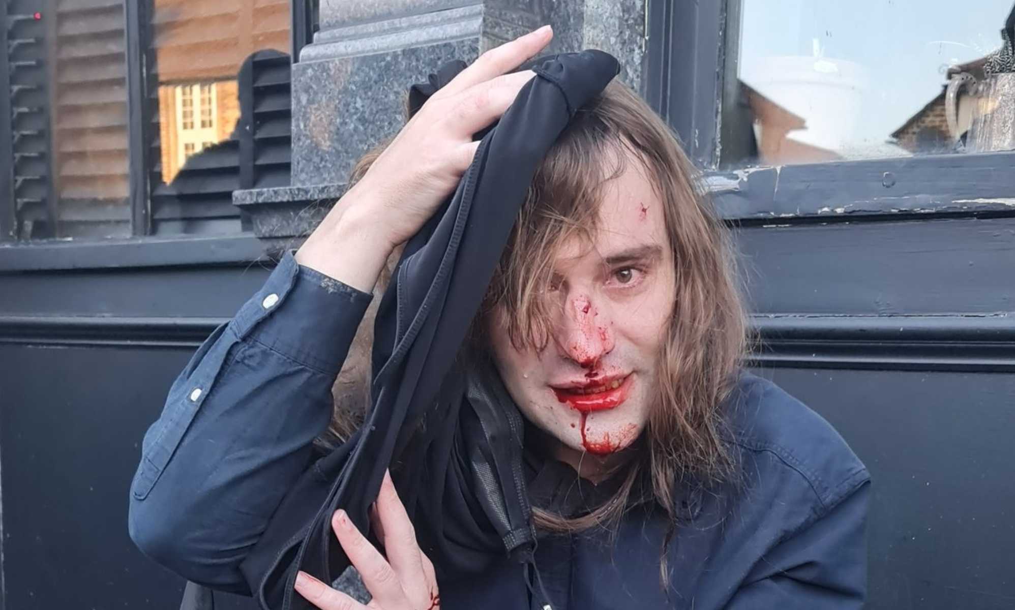 Met admits it's 'possible' that LGBTQ+ activist was injured by officer at chaotic anti-drag protest