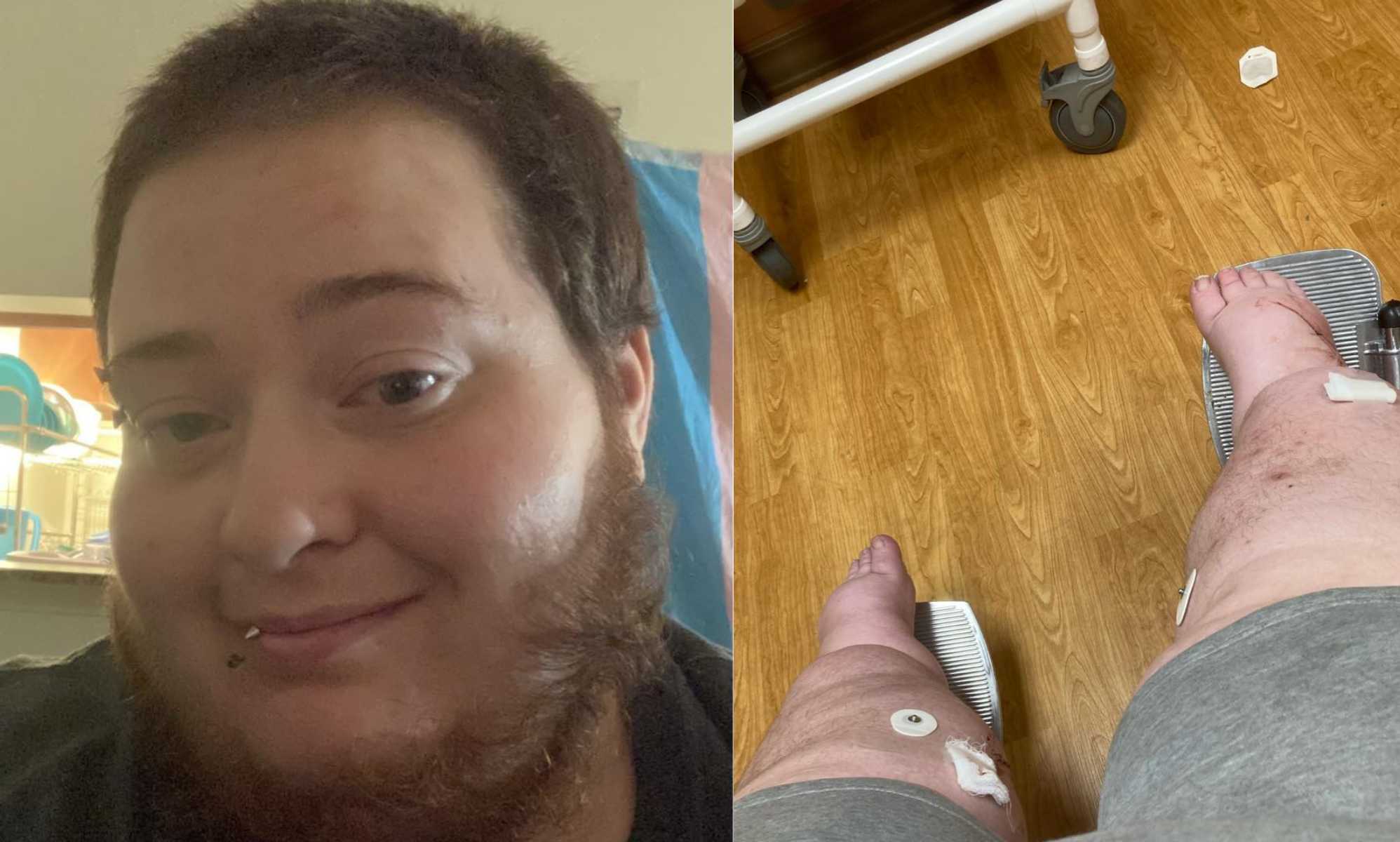 Trans man hospitalised after being shot with pellet gun while shopping for groceries
