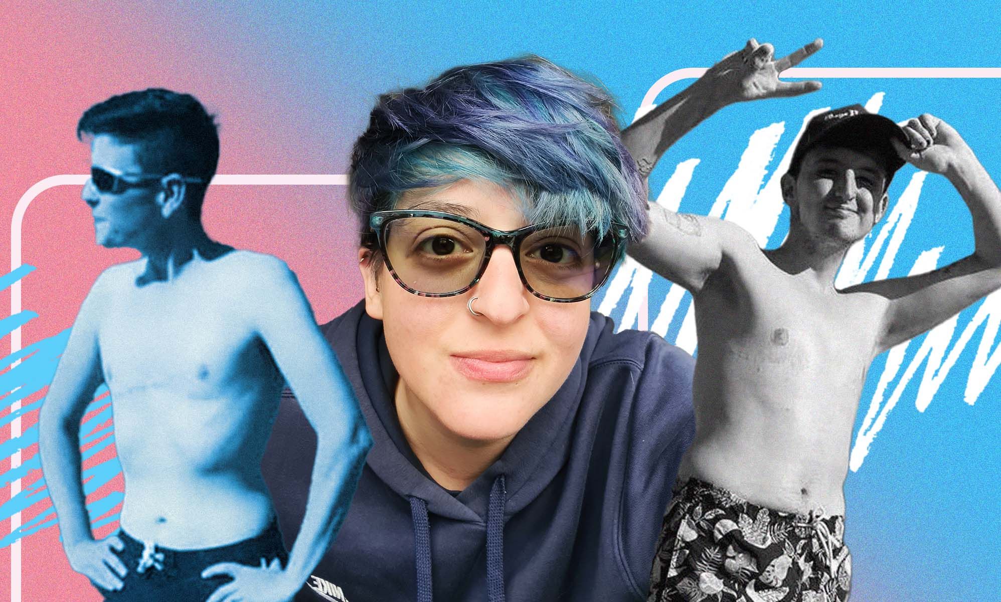 'I woke up as me': Trans and non-binary people on joy of top surgery