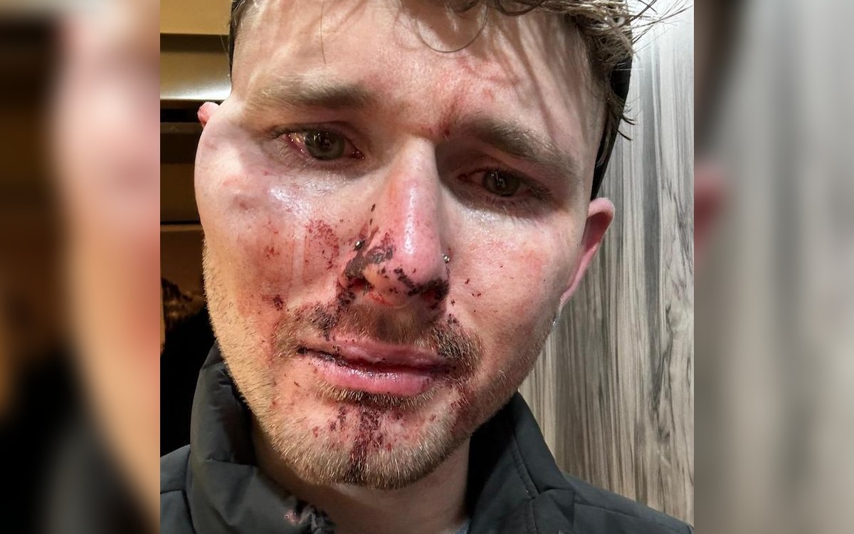 Gay man 'beaten, bitten and spat on' in Nottingham attack