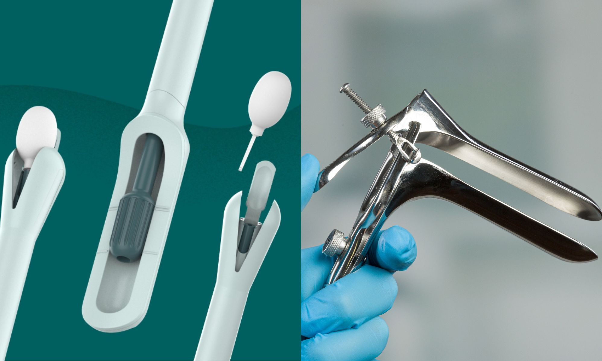 The first at-home cervical screening device is under clinical trial, and it's about time