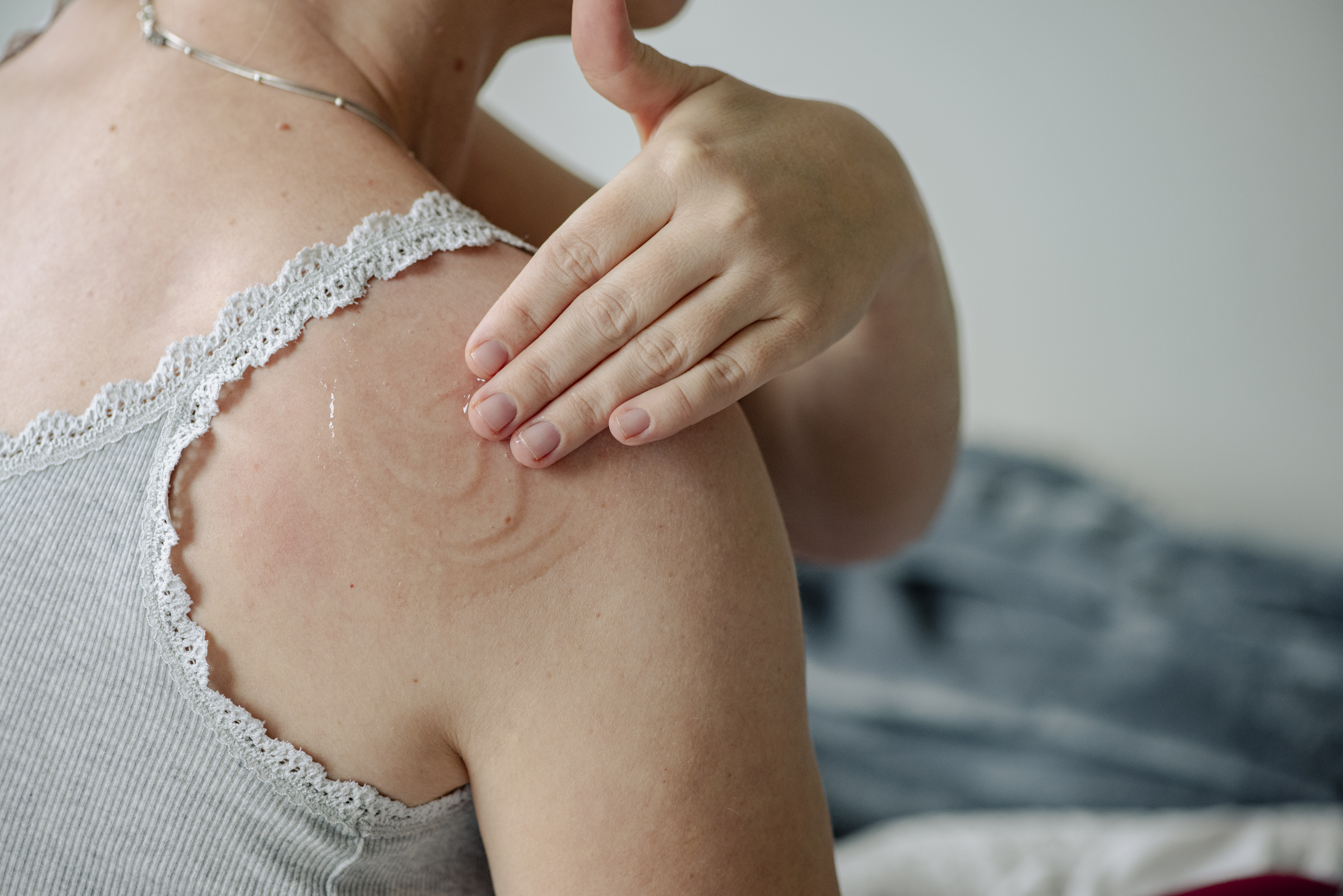 Image of a woman applying HRT gel on her shoulder