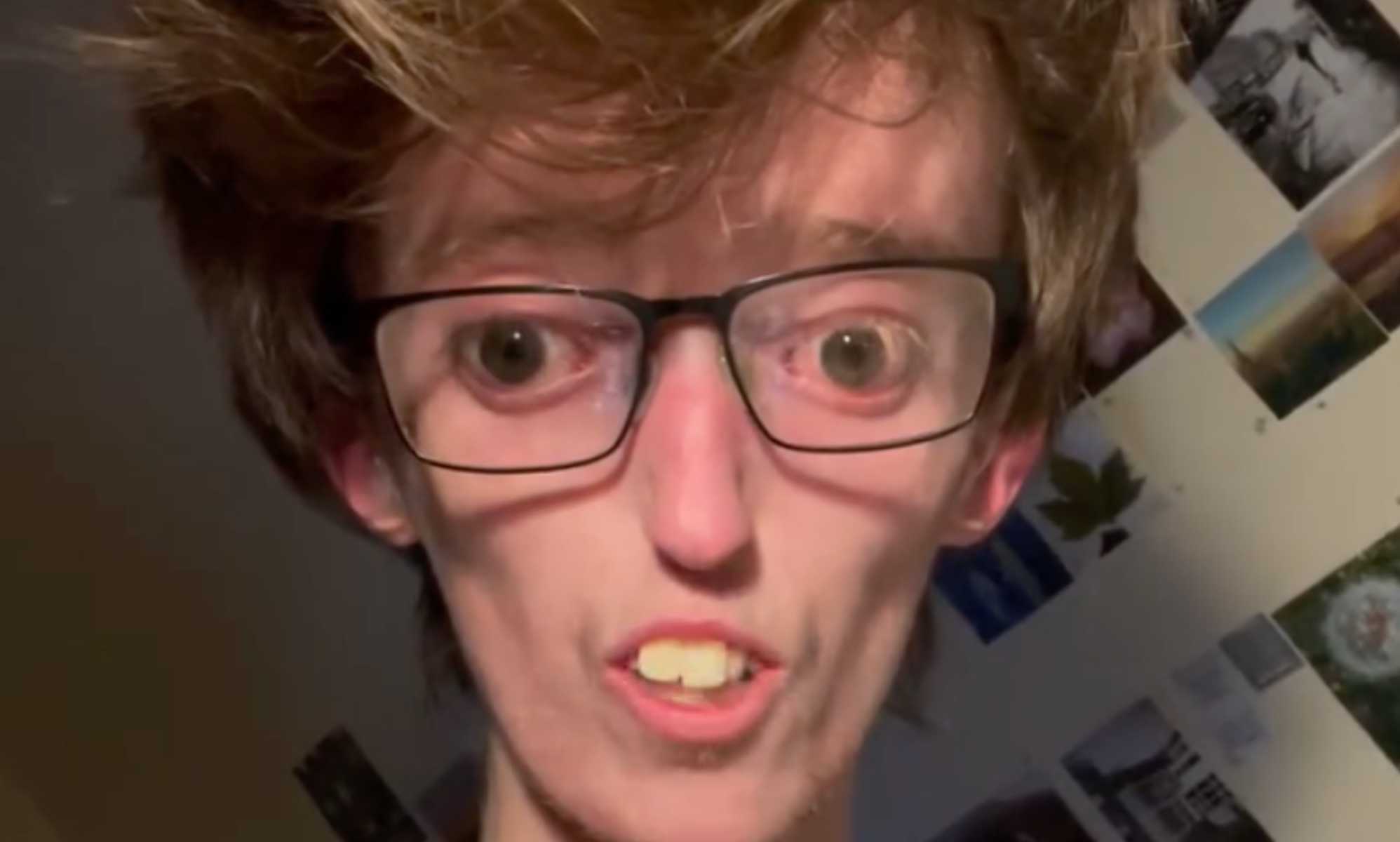 'Only 15 people in the world have my condition': Disability activist uses TikTok to raise awareness