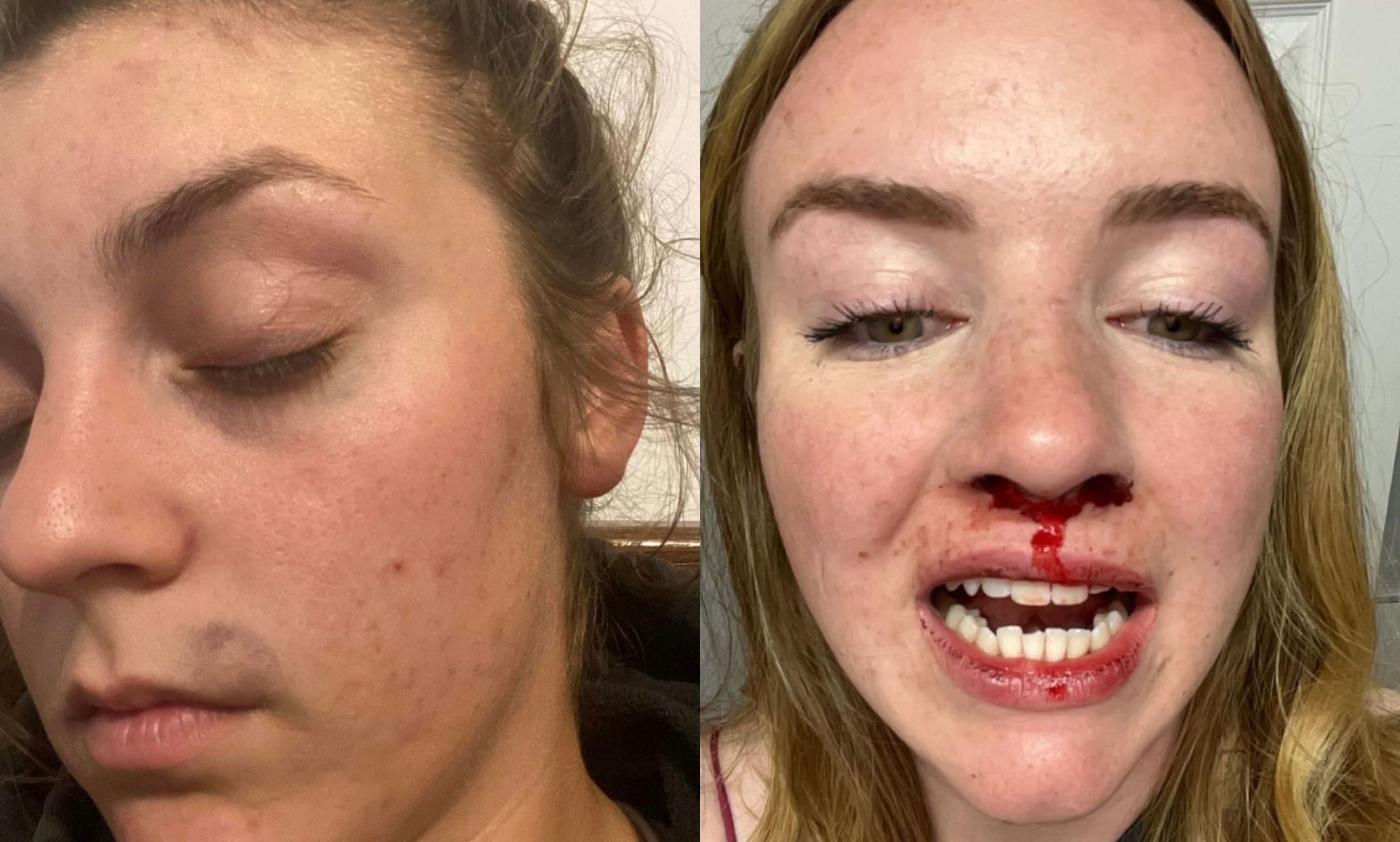 Lesbian couple beaten by group of men after birthday night out