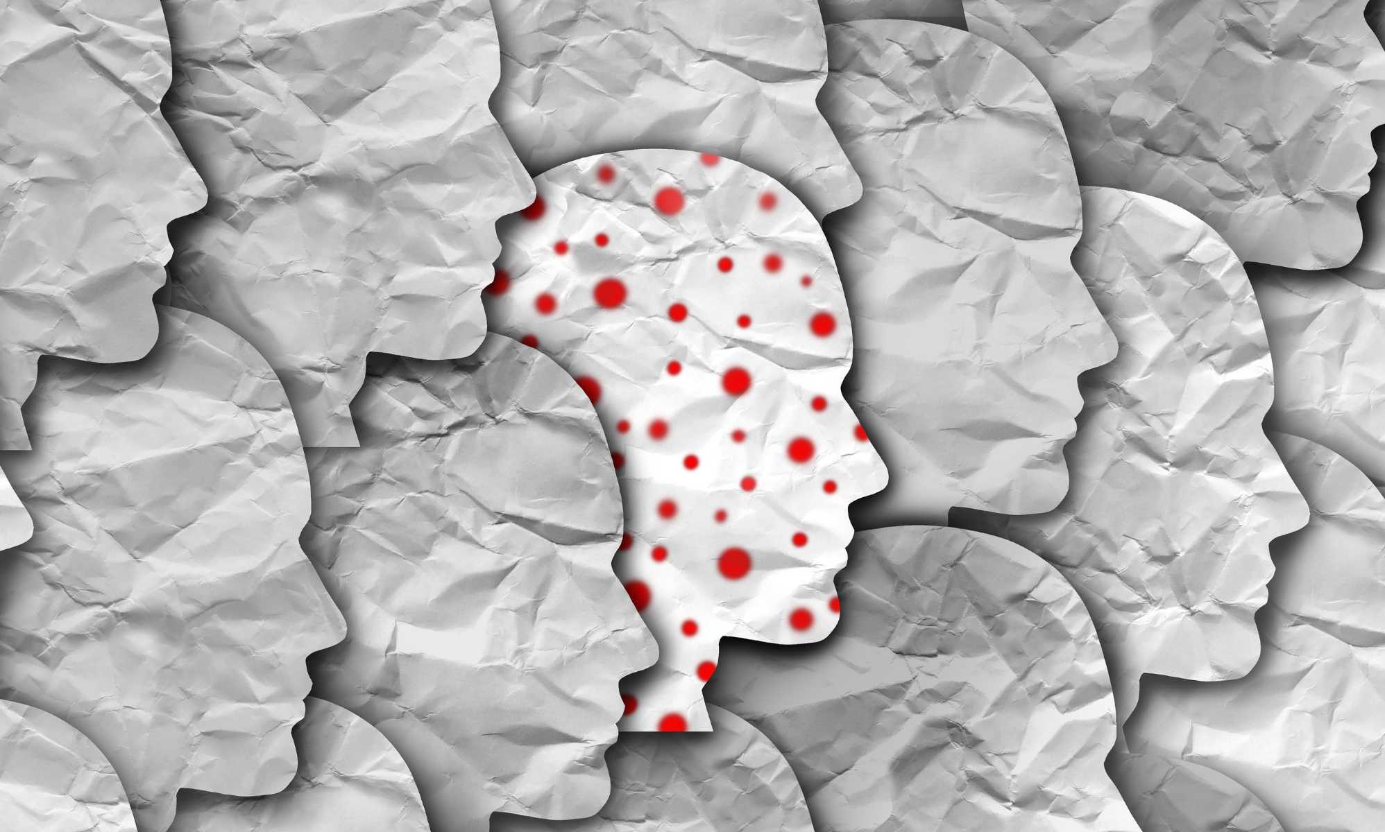 Mpox is not a 'gay disease' – here's what you need to know