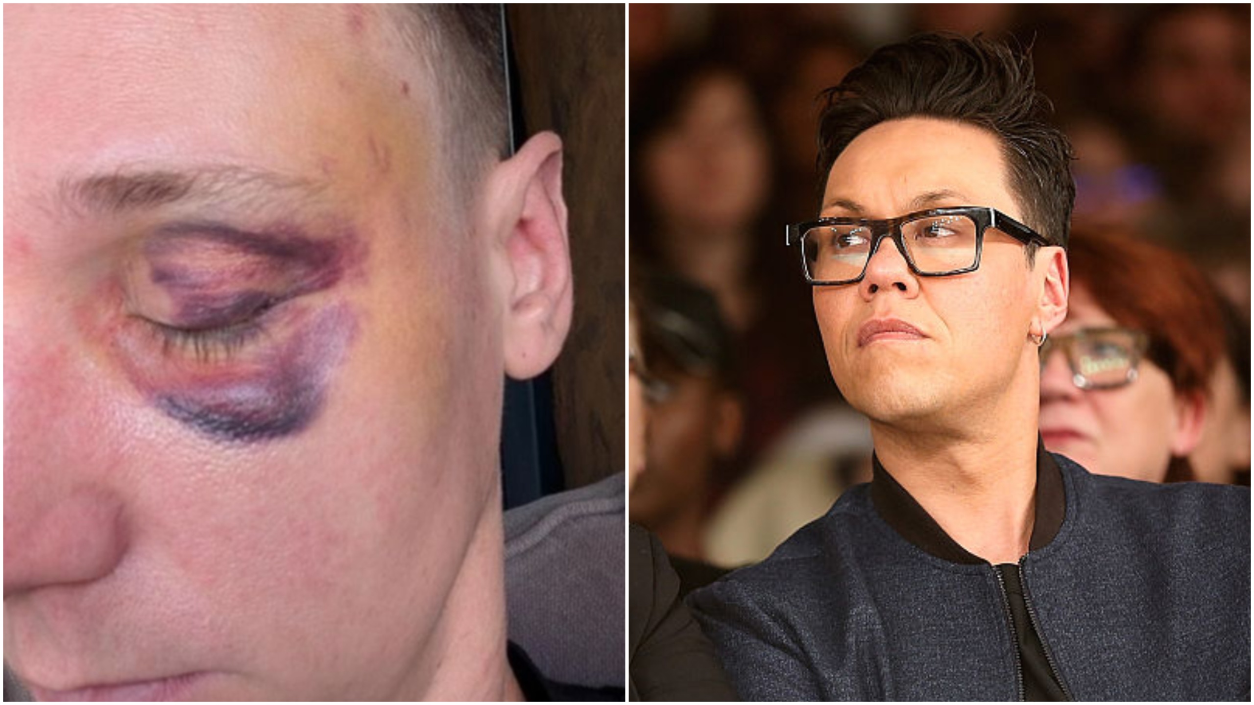 Gok Wan shares harrowing images of assistant attacked in 'horrific' homophobic hate crime