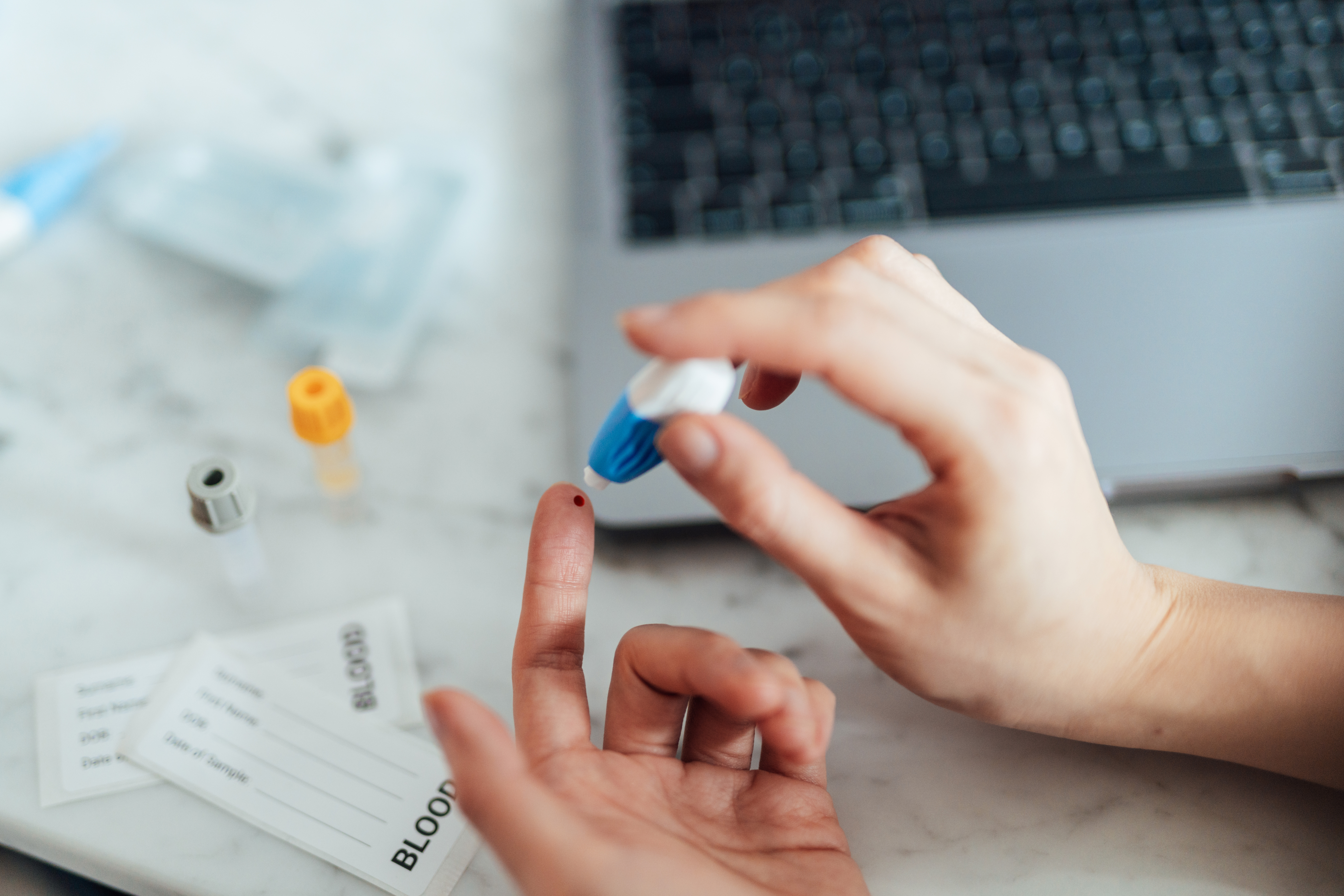 Fall in new HIV diagnoses among gay and bi men in England