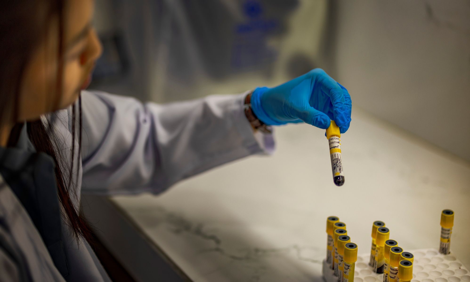 A person looking at a vial of blood in a test lab.