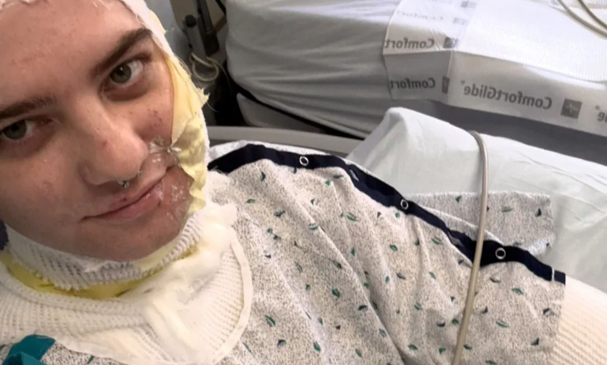 Thousands raised to help trans woman left with third-degree burns after acid attack