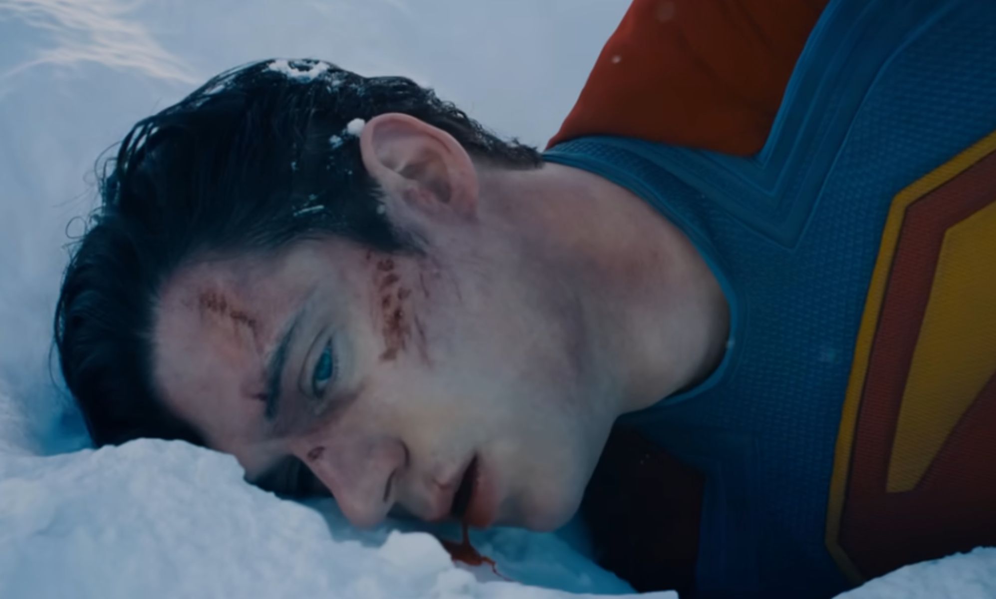 David Corenswet received a – quite literally – ball-busting injury while filming Superman