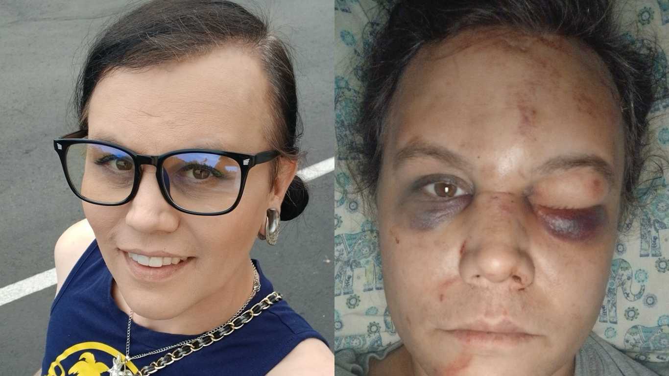 US trans woman who was viciously attacked says Trump ‘greenlit this type of violence’ 