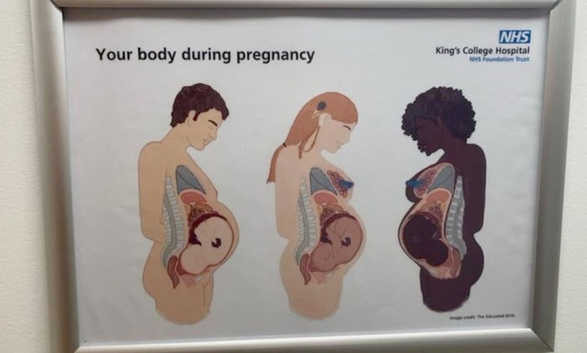 The usual suspects are raging at a male pregnancy NHS diagram that doesn't technically exist