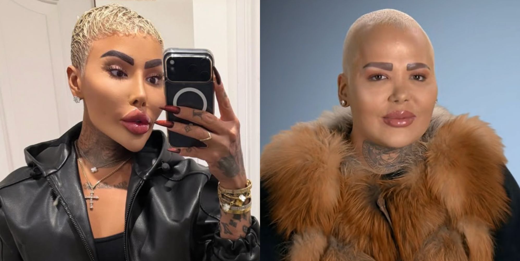 Arrests made over death of Botched star 'Lip King' Jordan James Parke